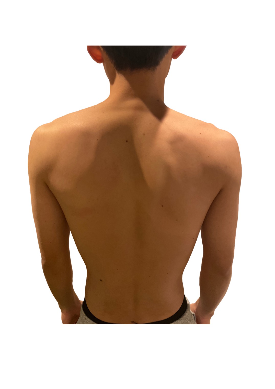 20代男性 アフター